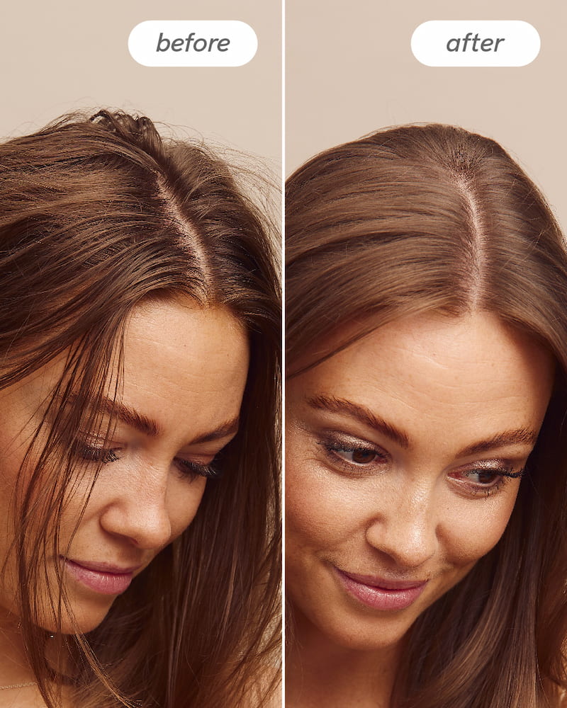 Scalp Delight™ Scalp Massage Brush - Image 4